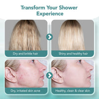 Clossyo Shower Filter - Original thumbnail 4
